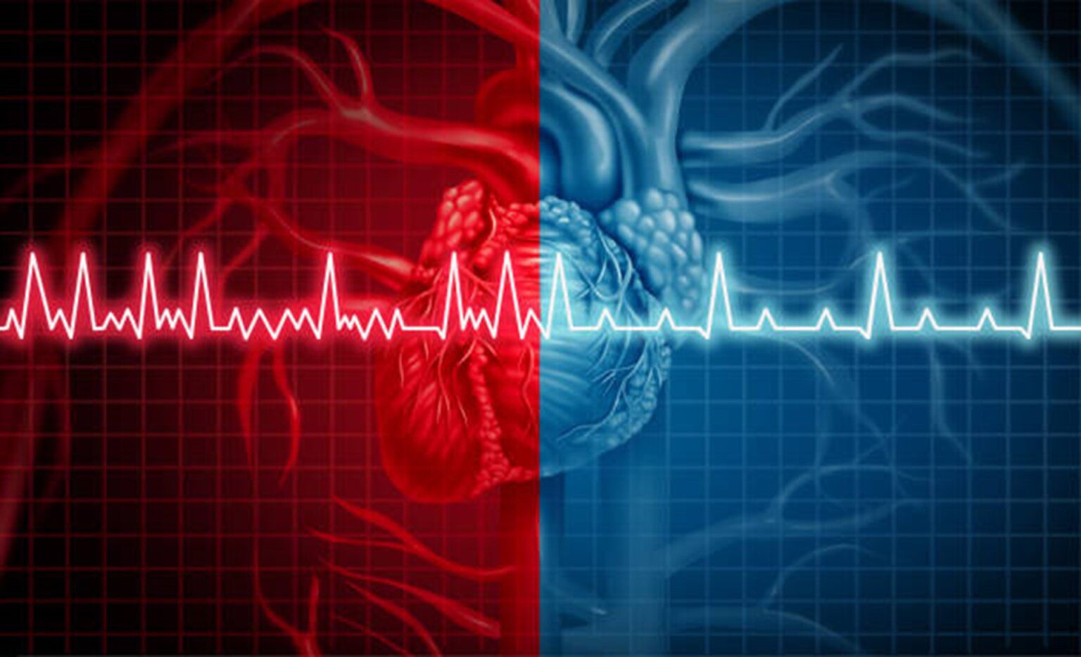 Radio Frequency Heart Catheter AltaSim Technologies, LLC